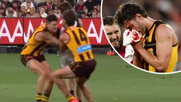 Jack Scrimshaw and Josh Battle collide (left), and Scrimshaw walking off.