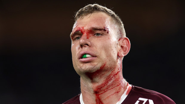 Tom Trbojevic of the Sea Eagles.