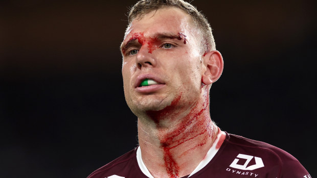 Tom Trbojevic of the Sea Eagles.
