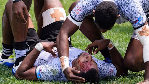 Vilimoni Derenalagi of Fiji lies injured on the field.