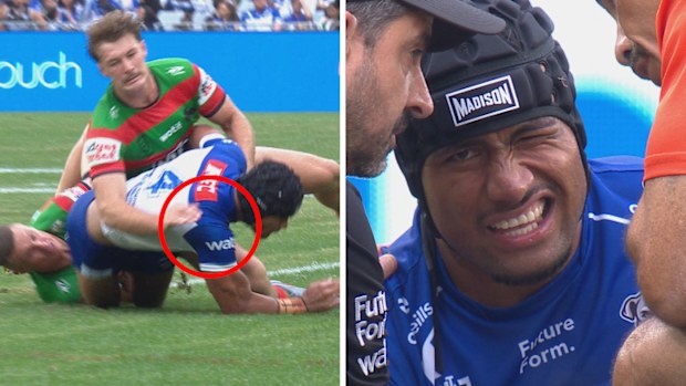 Stephen Crichton came straight off the field after suffering a suspected shoulder injury in the Bulldogs Good Friday clash with the Rabbitohs.